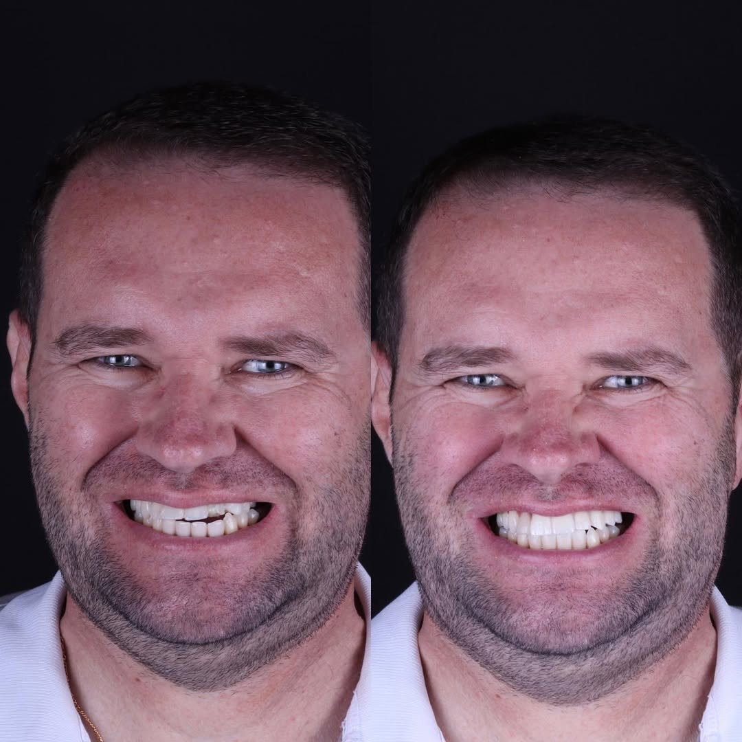 SnapInsta.to_315295274_192768019940831_4377542568216953527_n